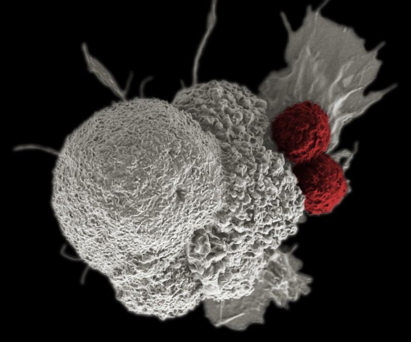 细胞Medica Car-T细胞疗法癌症治疗